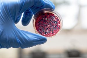 gut health test e coli